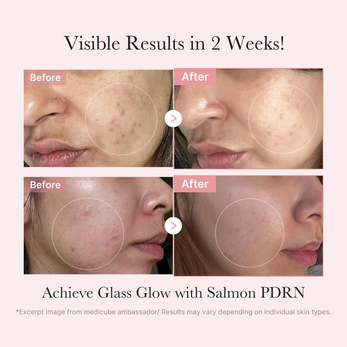 medicube serum and ampoule duo arranged to show concentrated treatment benefit