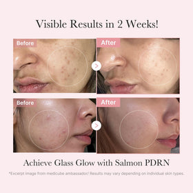 medicube serum and ampoule duo arranged to show concentrated treatment benefit