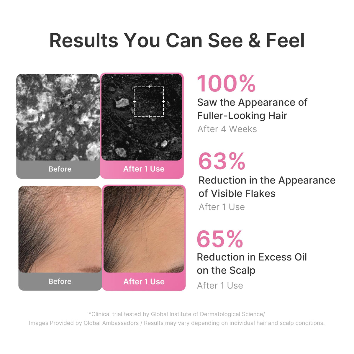 medicube scalp massage in-use illustrating cooling, refreshing effect