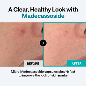 MEDIHEAL open jar highlighting madecassoside-rich cream for soothing benefits