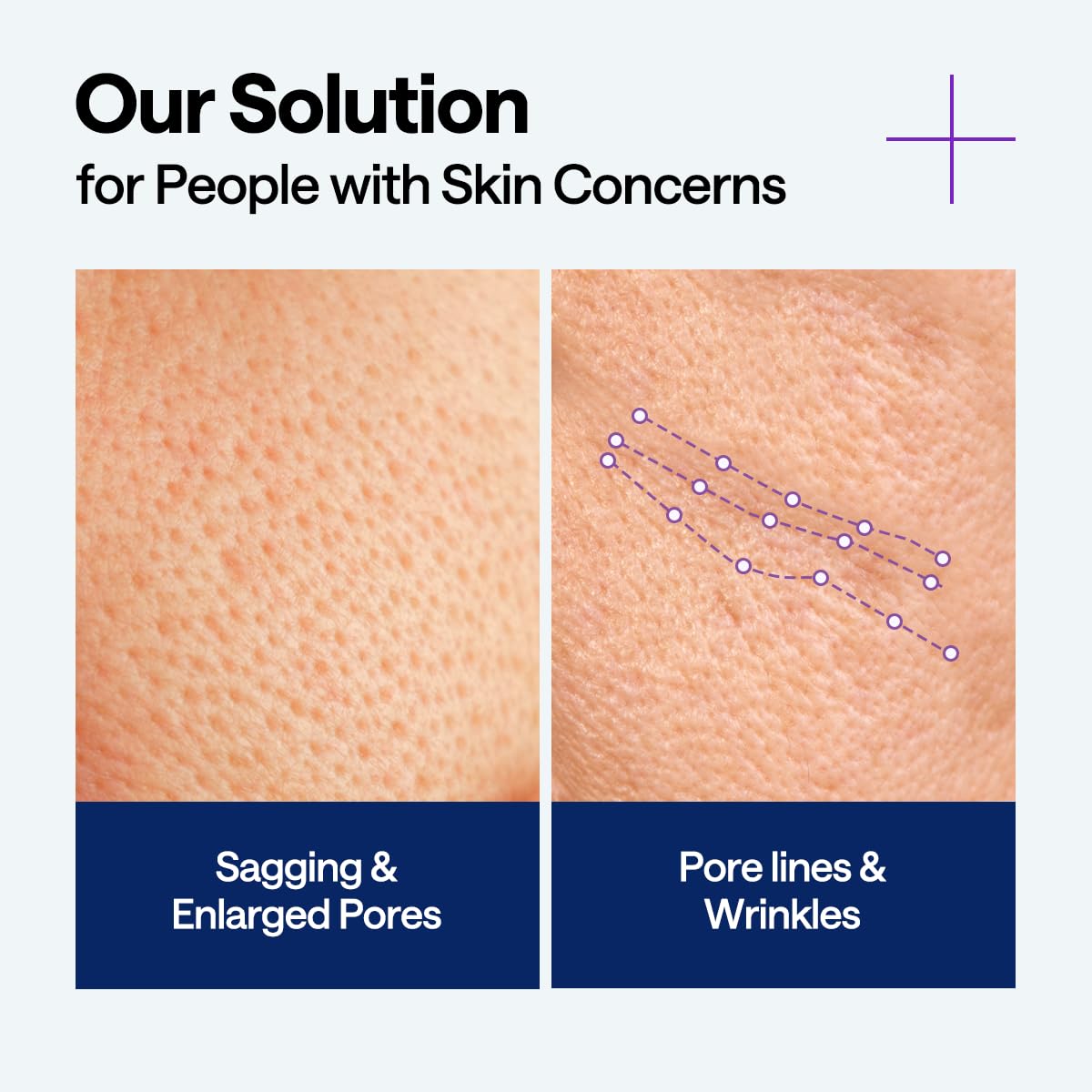 MEDIHEAL squalane ingredient vial highlighting moisturizing benefits and skin-friendly oil