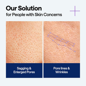 MEDIHEAL squalane ingredient vial highlighting moisturizing benefits and skin-friendly oil