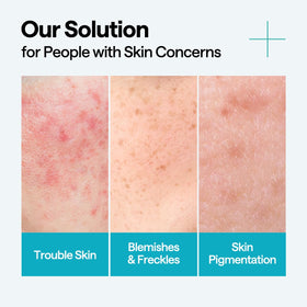 MEDIHEAL applied on hand demonstrating spreadability and quick skin absorption