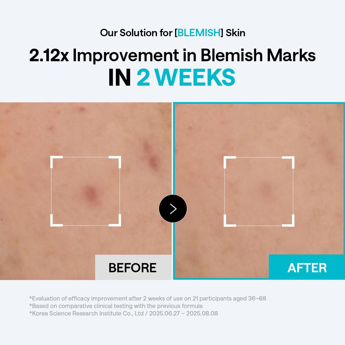 MEDIHEAL pad placed on cheek as spot mask for targeted calming benefit