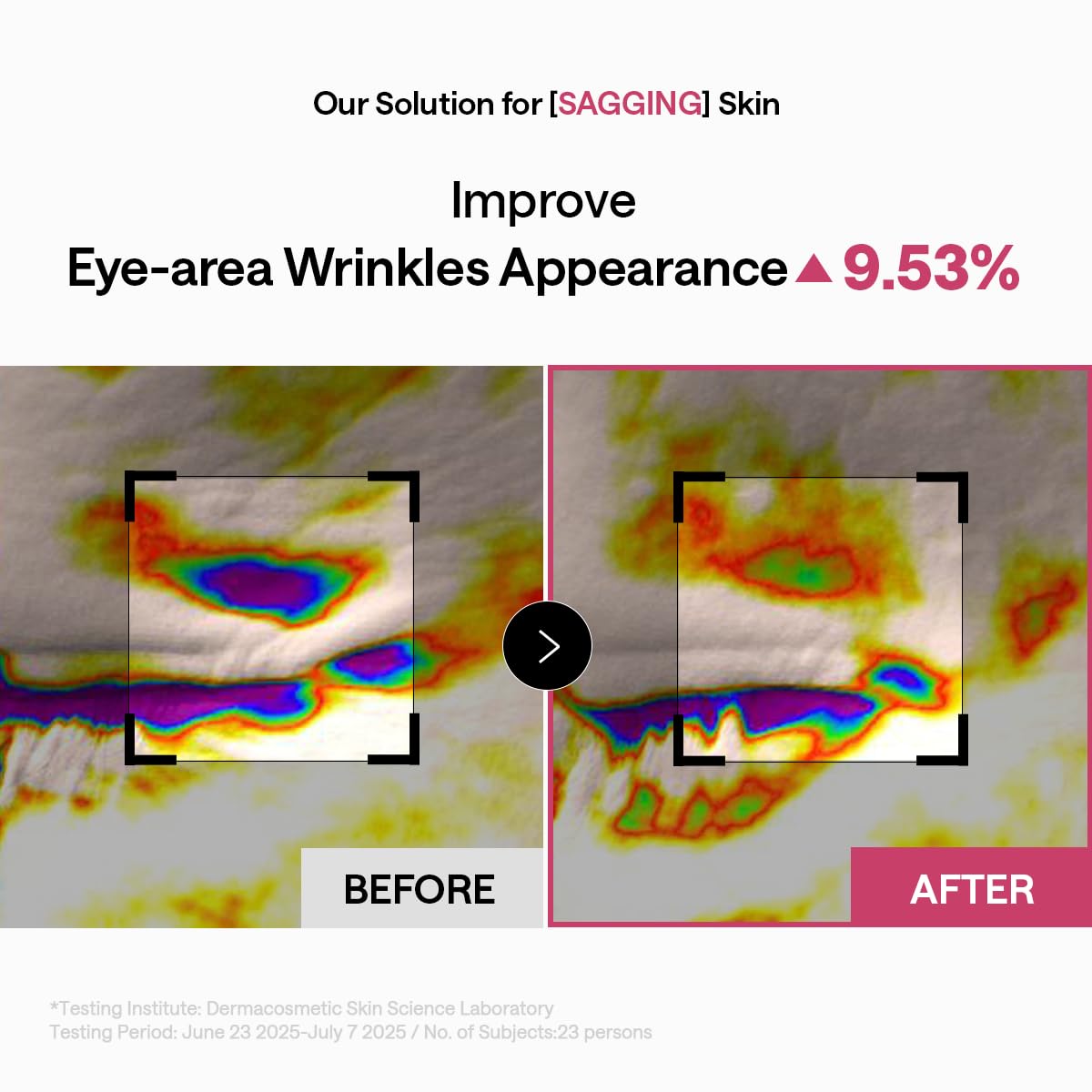 MEDIHEAL patch on forehead displaying multi-zone fit and wrinkle-smoothing action