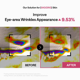 MEDIHEAL patch on forehead displaying multi-zone fit and wrinkle-smoothing action