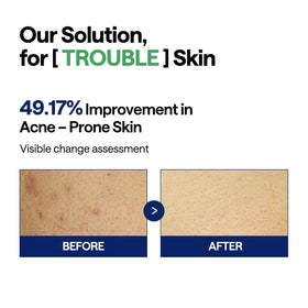 MEDIHEAL tea tree ingredient focus highlighting calming botanical support