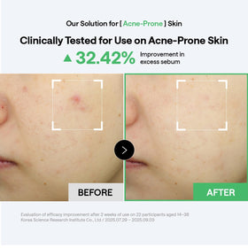 MEDIHEAL pads applied as spot mask to target blemishes and oil