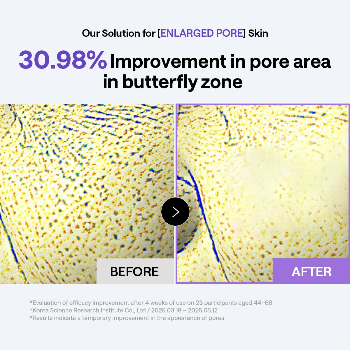 MEDIHEAL pad on jawline illustrating adhesion and contour support