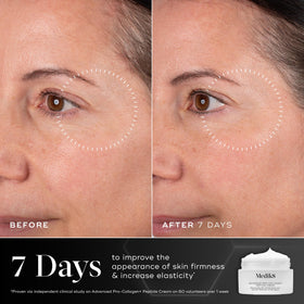 Medik8 application on hand demonstrating absorbent texture and immediate hydration benefit