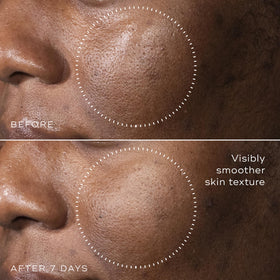 Medik8 hyaluronic acid visual macro emphasizing layered hydration benefits
