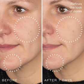 Medik8 serum on fingertip ready to apply showing easy spreadability benefit