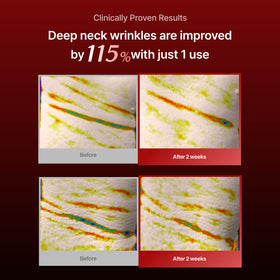 MEDITHERAPY model applying mask demonstrating secure neck fit
