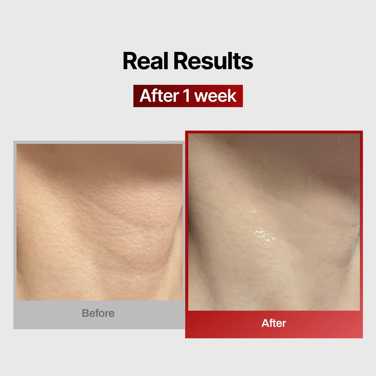 MEDITHERAPY glossy serum texture highlighting hydration boost