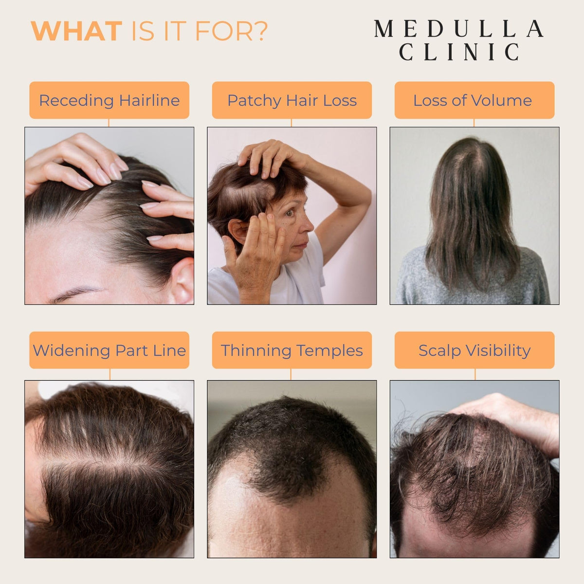 Medulla Clinic in-bathroom routine demonstrating daily no-mess application benefit