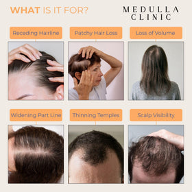 Medulla Clinic in-bathroom routine demonstrating daily no-mess application benefit