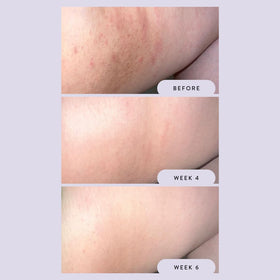 Megababe Night Rescue being applied to inner thigh for targeted overnight care