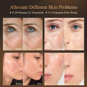 MEGELIN cushioned eye pads protecting eyes and increasing comfort during sessions