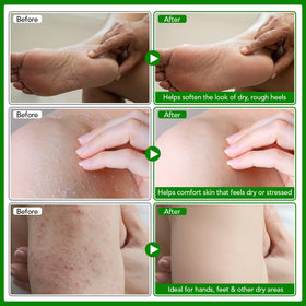 Meifenla balm applied to hands to soothe dry skin quickly