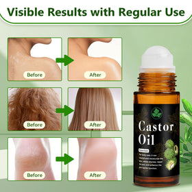 Melanther applying roll on to scalp for targeted nourishment and less mess