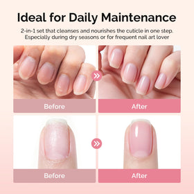 MelodySusie cuticle oil dropper applying moisturizing oil to nail fold