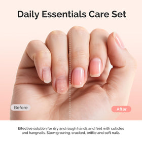 MelodySusie jelly-texture cuticle remover close-up for fast exfoliation