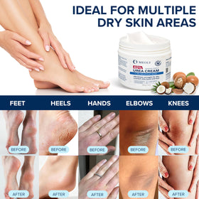 MEOLY label close-up highlighting 40% urea and 2% salicylic acid for ingredient clarity
