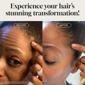 Meraz Pureauty Naturals application to scalp demonstrating targeted coverage benefit