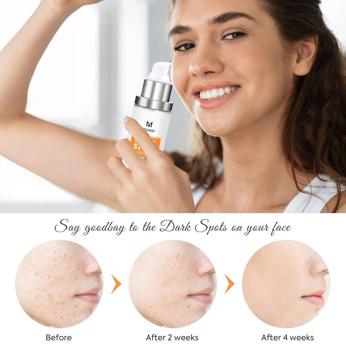MESANDY applying cream to cheek showing targeted spot treatment