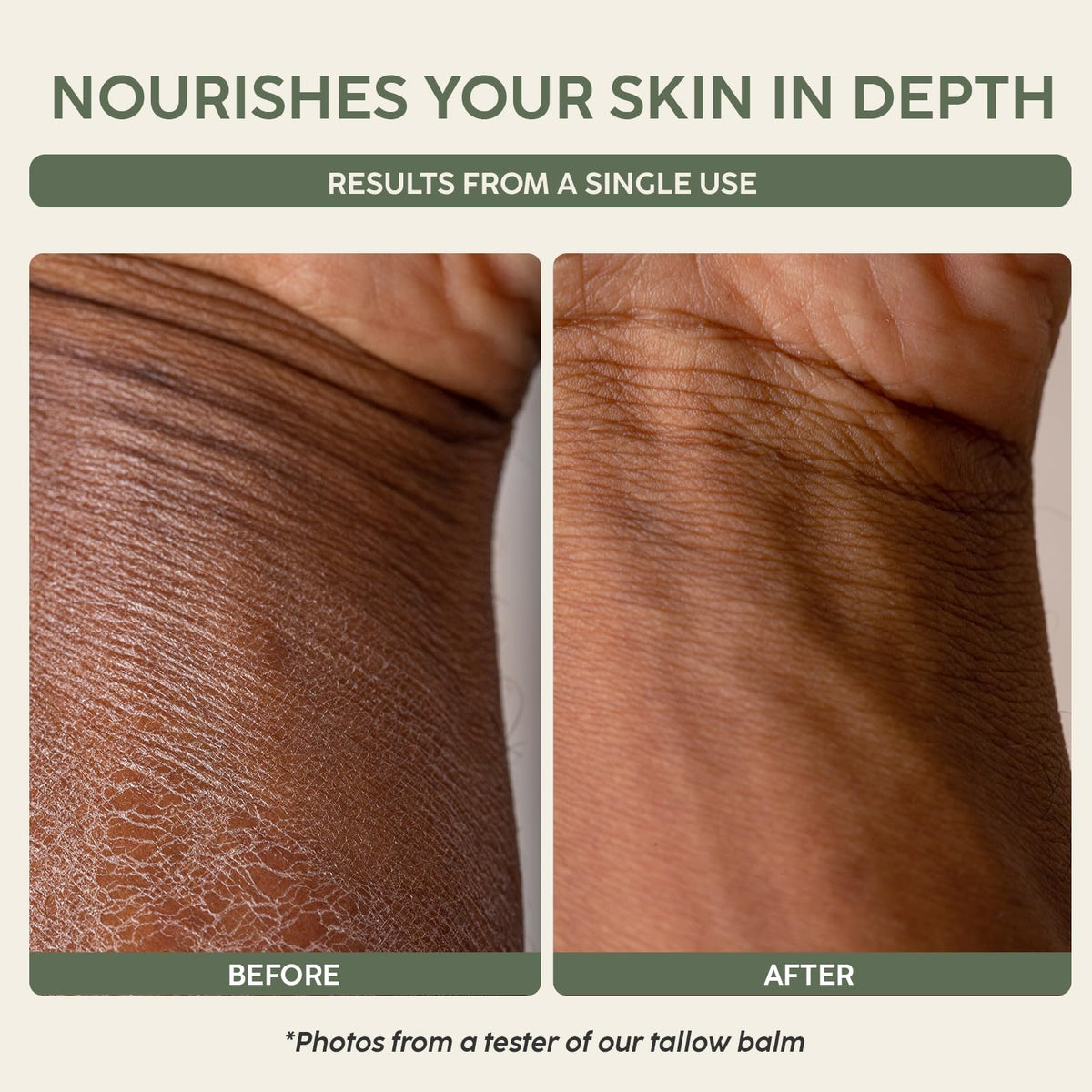 Mespok applied to hand demonstrating quick absorption and barrier support benefit