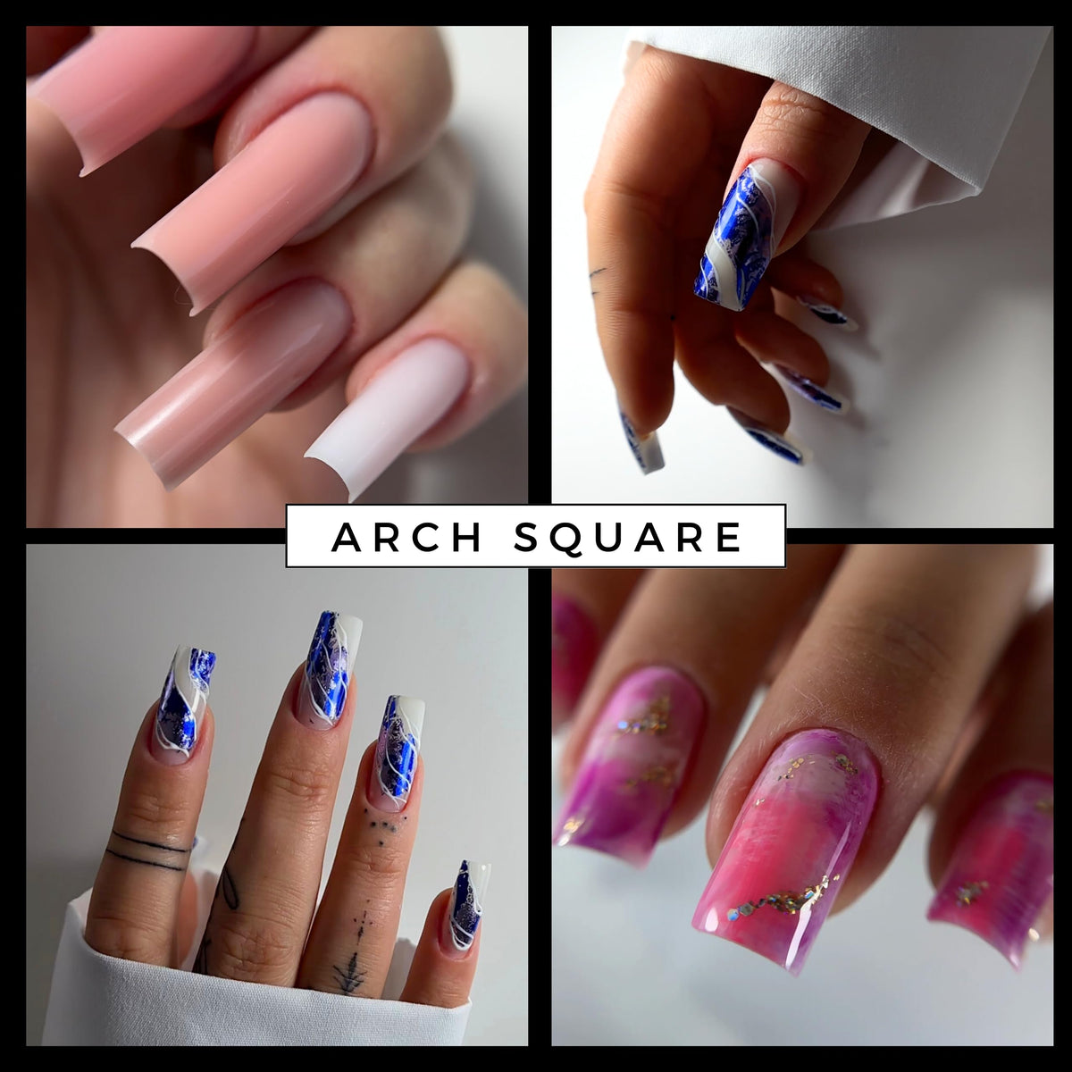 MGART size comparison on hand demonstrating correct fit and consistent results