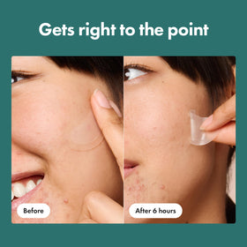 Mighty Patch with salicylic acid and willow bark visuals highlighting ingredient support for exfoliation