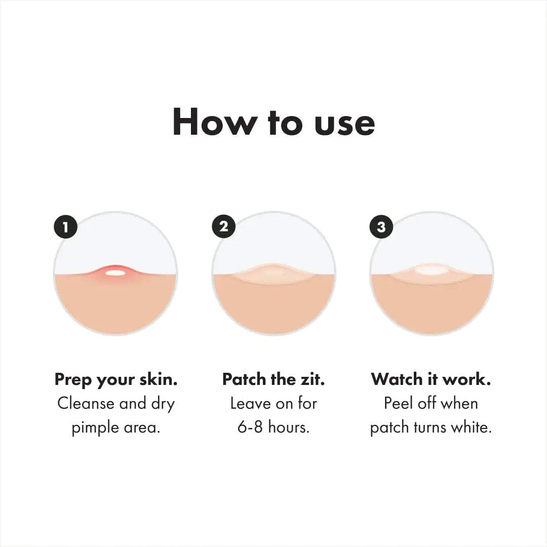 Mighty Patch Invisible+ on cheek blending into skin for low-profile daytime wear and confidence benefit