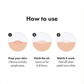 Mighty Patch Invisible+ on cheek blending into skin for low-profile daytime wear and confidence benefit