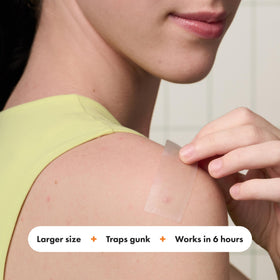 Mighty Patch on upper back showing body acne coverage and secure fit