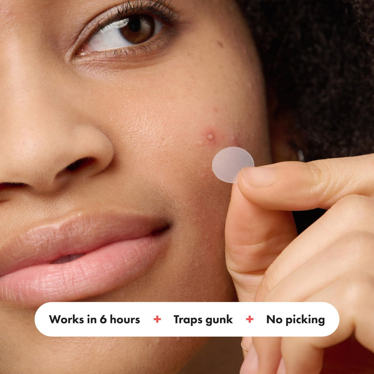 Mighty Patch applied on cheek overnight showing discreet coverage and protection