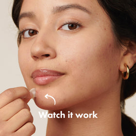 Mighty Patch perforated sheet display by Hero Cosmetics for easy peel convenience