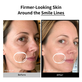 millimilli nozzle close-up highlighting fine spray texture and even coverage