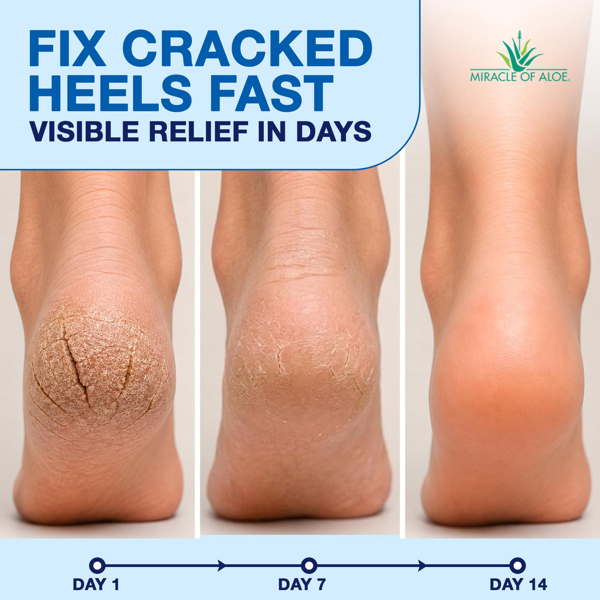 Miracle of Aloe close-up applicator glide for mess-free application