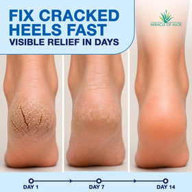 Miracle of Aloe close-up applicator glide for mess-free application