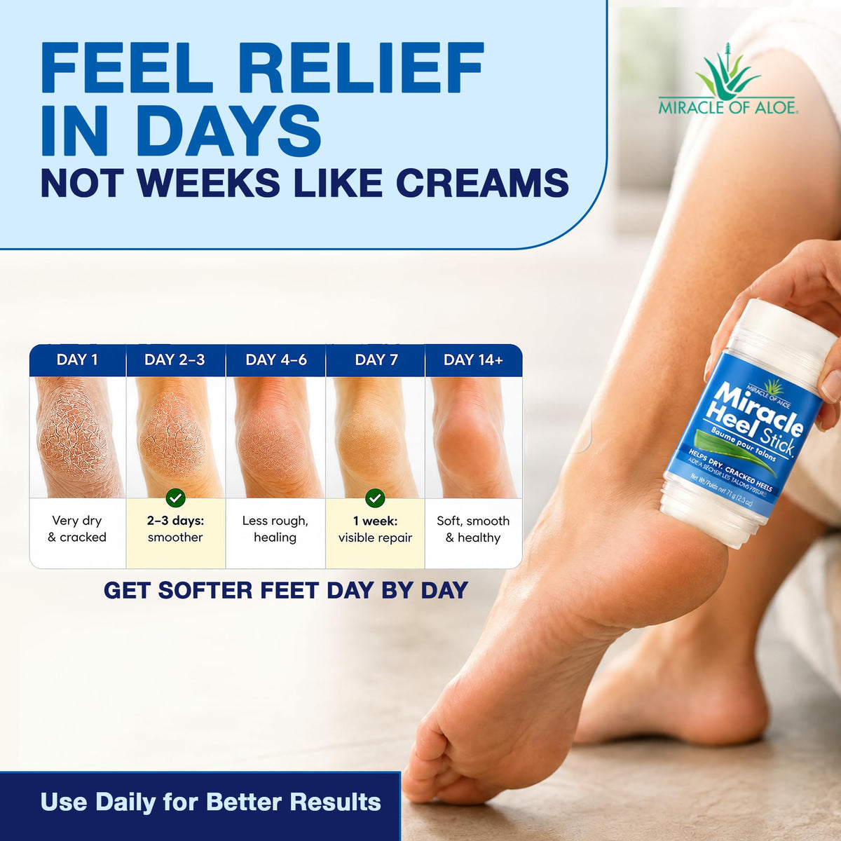 Miracle of Aloe texture on heel demonstrating deep moisturization