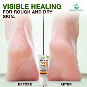 Miracle of Aloe label close-up showing ingredients and clarity