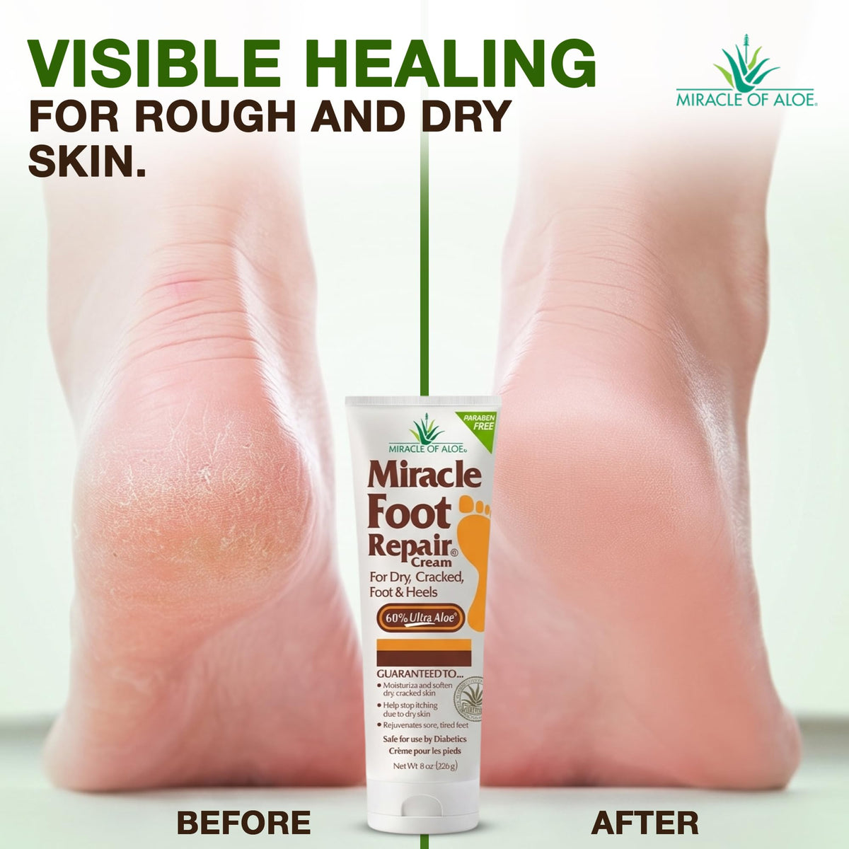 Miracle of Aloe label close-up highlighting 60% UltraAloe concentration