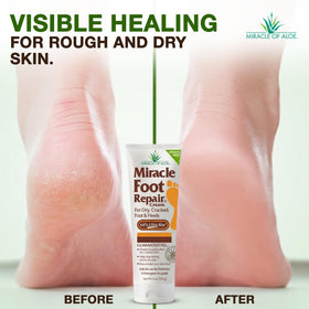 Miracle of Aloe label close-up highlighting 60% UltraAloe concentration