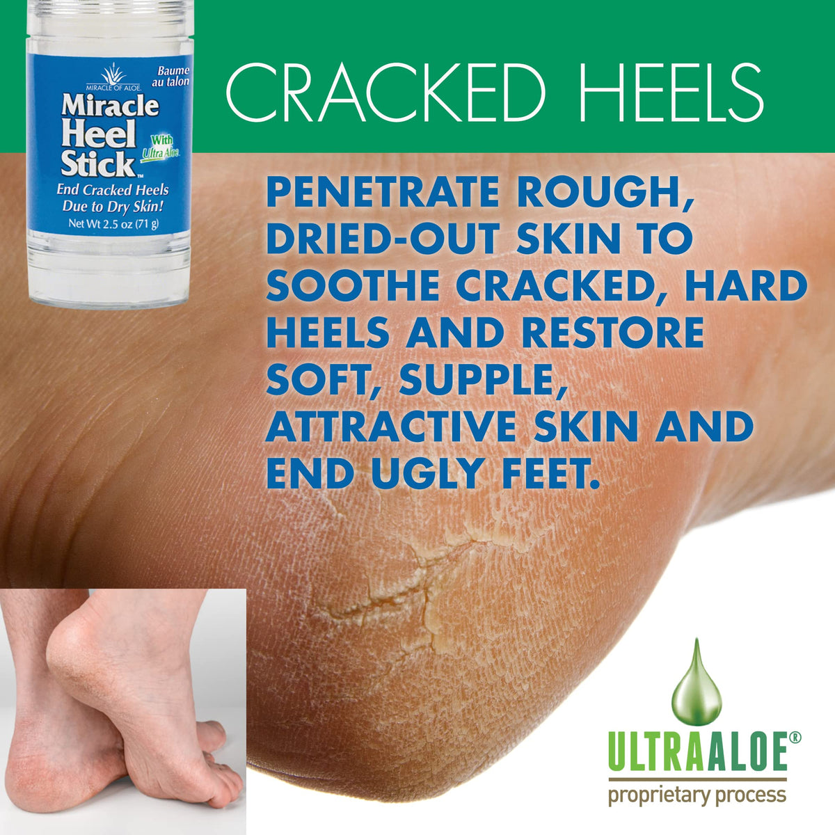 Miracle of Aloe stick applicator close-up displaying easy mess-free use