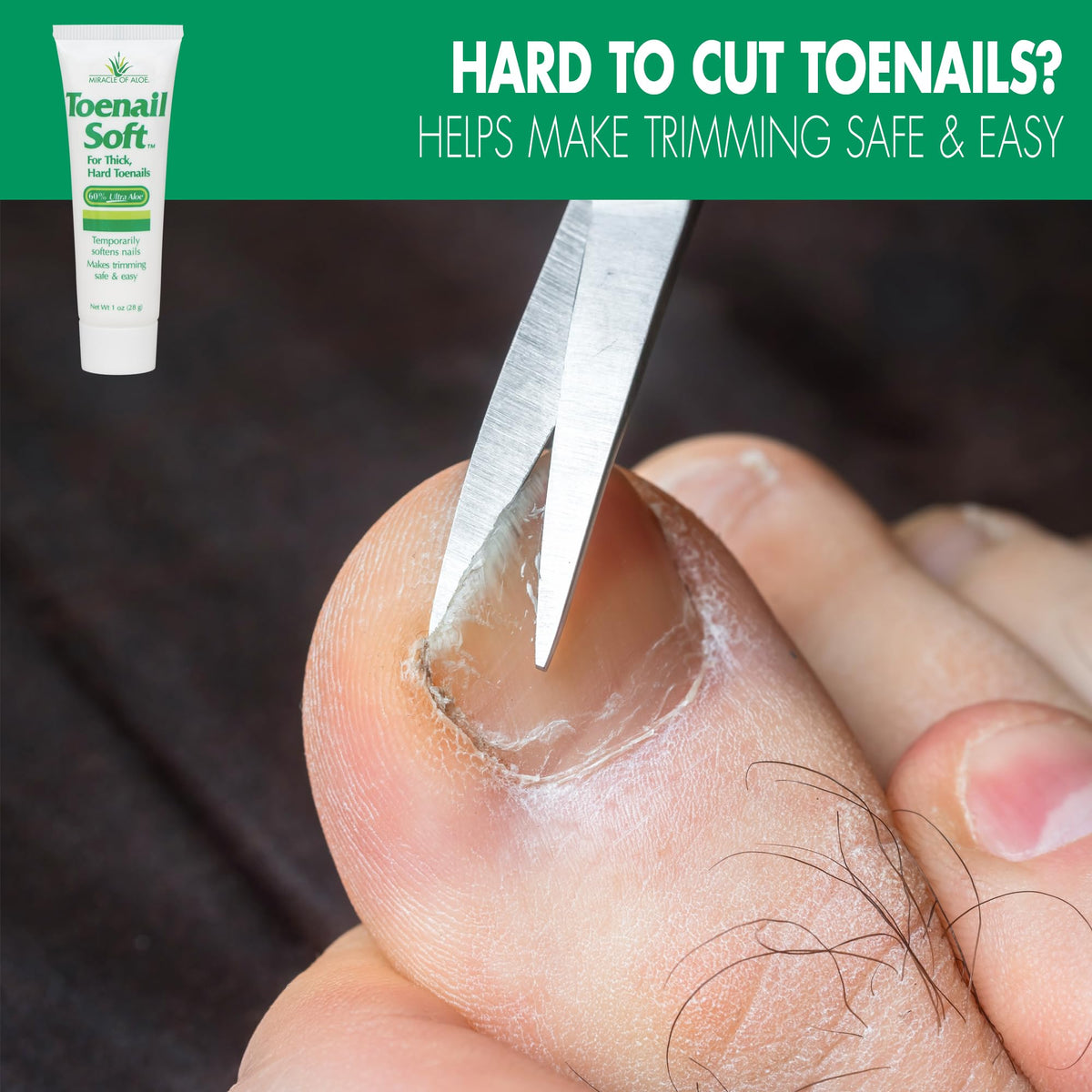 Miracle of Aloe cream texture close-up showing smooth non-greasy consistency benefit