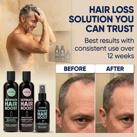 Moerie spray nozzle applying serum-level mist to thinning areas
