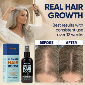 Moerie serum droplet on scalp highlighting lightweight texture for fast absorption