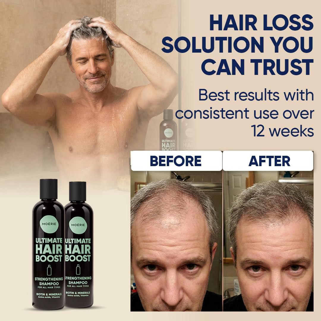 Moerie in shower usage showing scalp massage and improved routine benefit