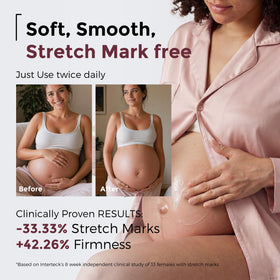 Momcozy cream on hand demonstrating quick absorption and comfort